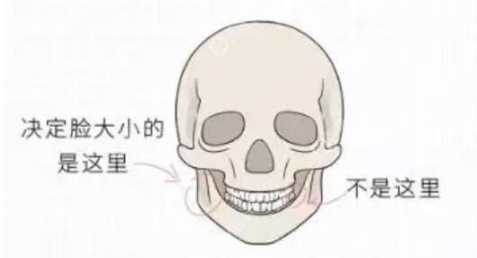 颧骨内推和下颌角哪个风险大