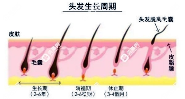 脂溢性脱发可以自愈吗