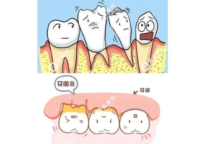 各种牙龈问题的治疗方式