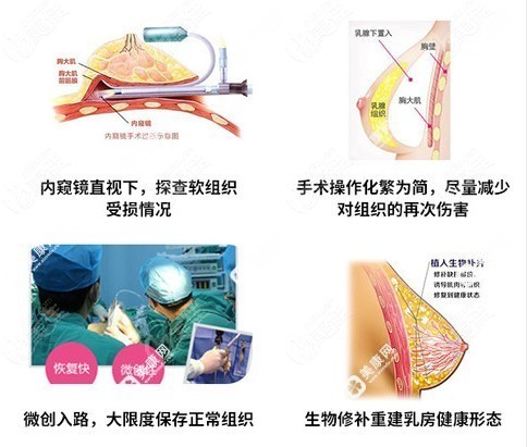 广州荔湾区人民医院隆胸技术优势