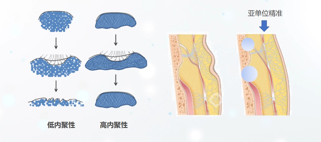 莉莉公主玻尿酸打下巴成效好