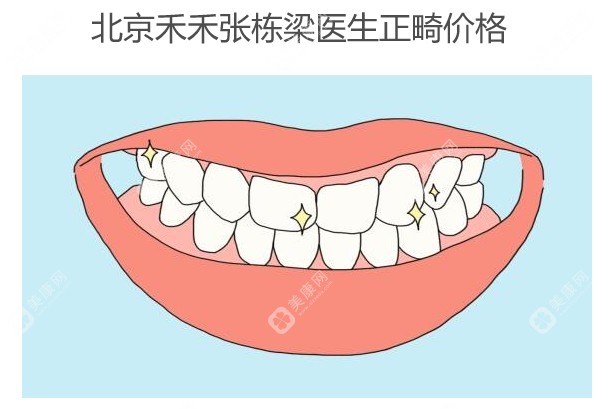 北京禾禾张栋梁医生正畸价格