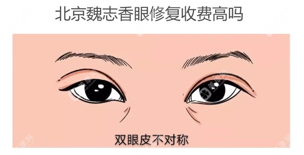 北京魏志香眼修复收费高吗www.slzxedu.com