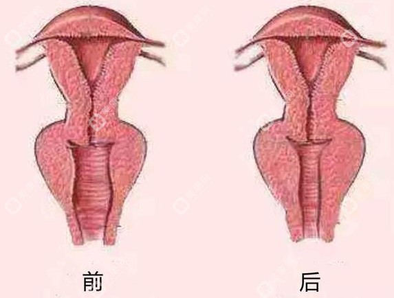 西安緊縮針怎么預(yù)約-24小時在線預(yù)約入口