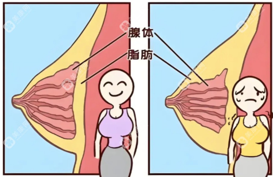 slzxedu.com刘成胜脂肪隆胸价格