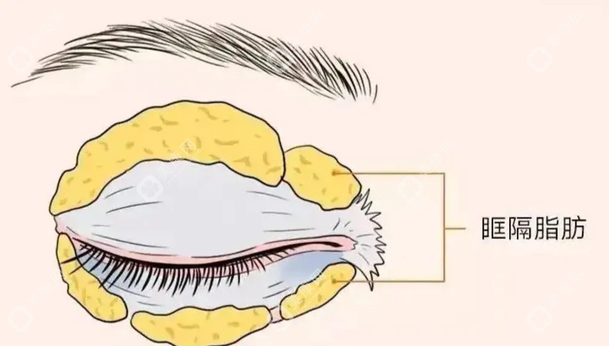 2025国内下眼睑修复好的医生 