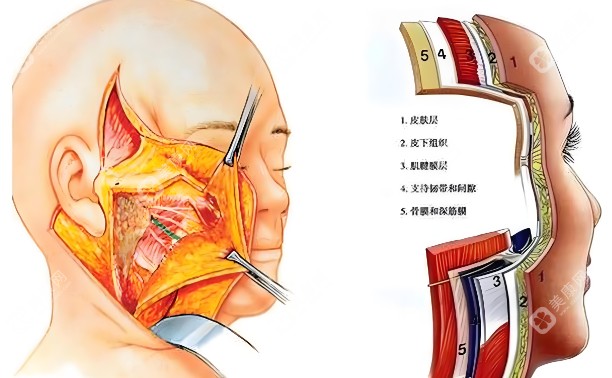 拉皮手术医院北京加减美怎么预约