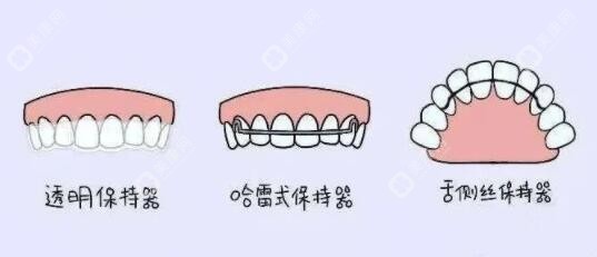 2025牙齿矫正收费价格表——矫正保持器价格