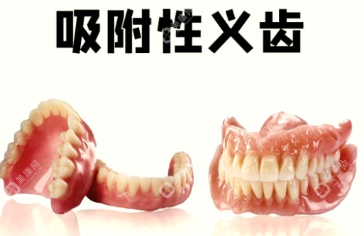 2025吸附义齿价格在1万-5万元起