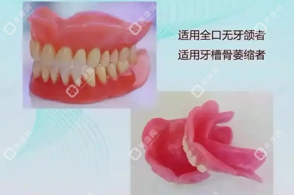 2025吸附义齿价格表分享-附吸附性假牙各品牌半口