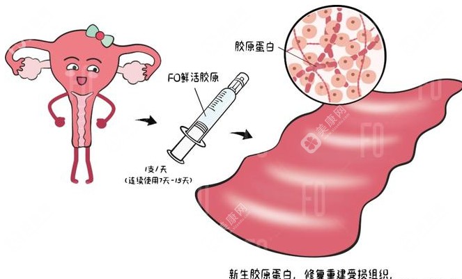 2025乌鲁木齐打紧缩针价格2800元起