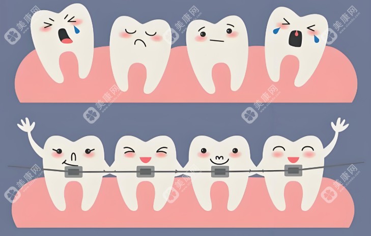 现在矫正牙齿多少钱一颗大概多少钱？价格有优惠，公布2025金属/隐形矫正牙齿价格