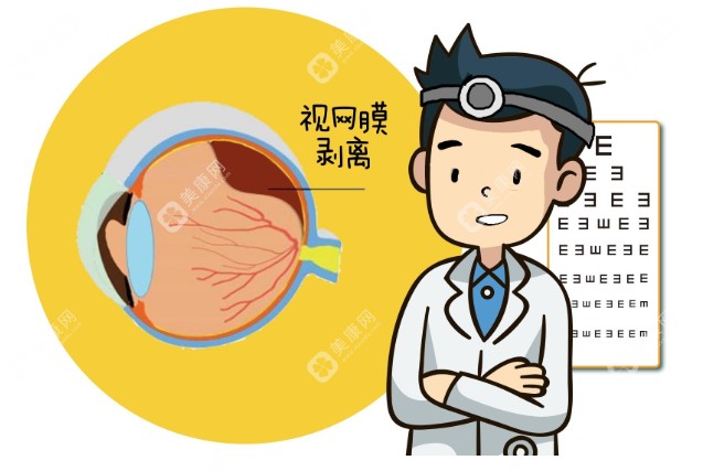 2025国内视网膜脱落手术医院医生排名前十名集中在北京上海辽宁成都内蒙古等地