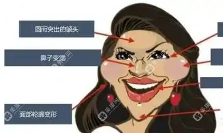 蒋铮铮修复馒化脸采用多种技术-满足不同顾客