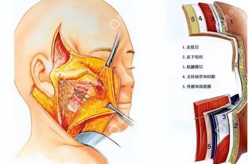 李晓东拉皮失败修复例子，李晓东医生很正规口碑也好没有负面拉皮新闻