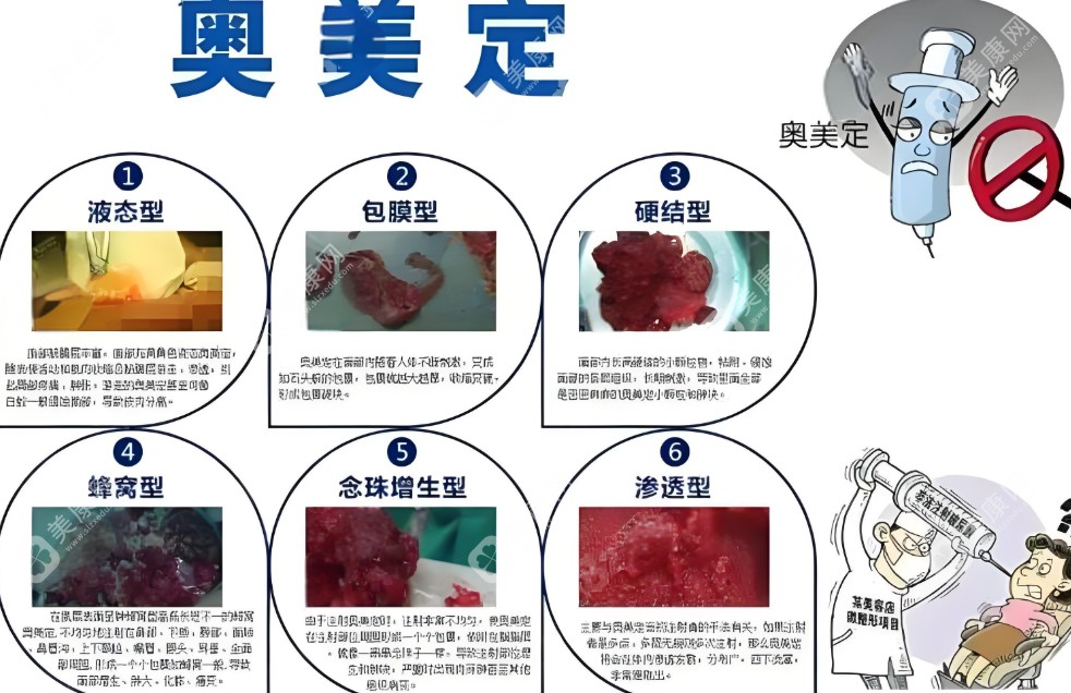 奥美定取出手术的急迫性www.slzxedu.com