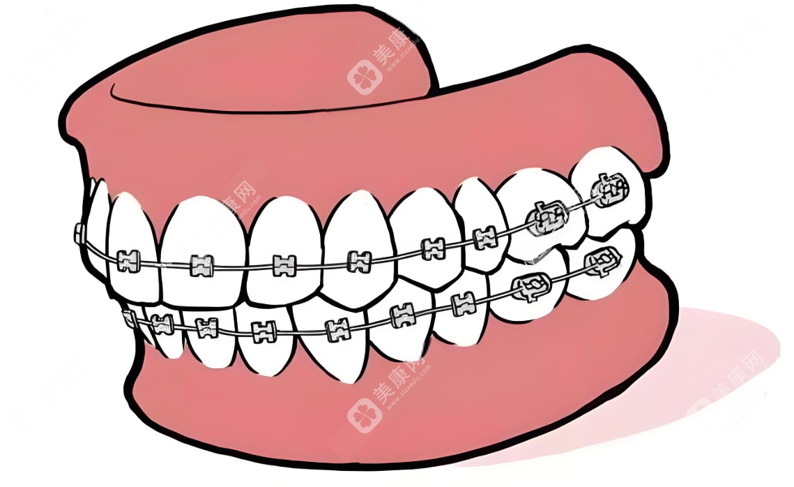 拜博口腔医院正畸多少钱?牙齿不对称矫正2.4万元起|凸嘴矫正3.2万元起|地包天矫正3.8万元起！