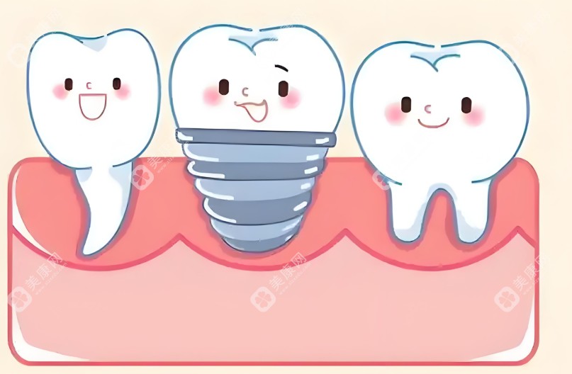 2025牙科诊所种植牙收费标准