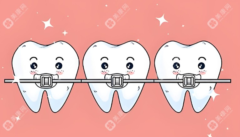 2025牙科诊所牙齿矫正收费标准