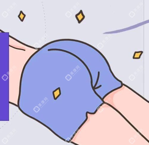 超脂塑体雕 + 定制假体丰臀高清图片