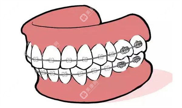 重庆口腔医院牙齿矫正价格表