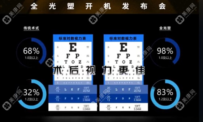 苏州明基医院太学眼科全光塑手术