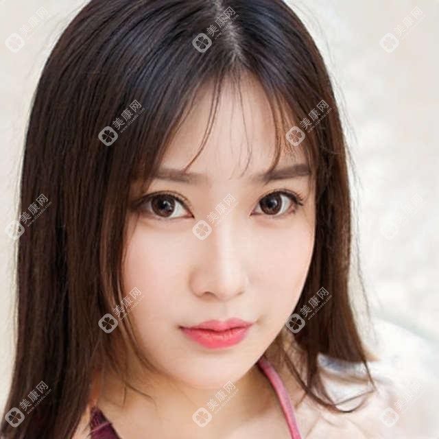合肥發(fā)際線種植價格表，地址在合肥長豐縣/廬江縣/巢湖市發(fā)際線種植費用在5688-11558元