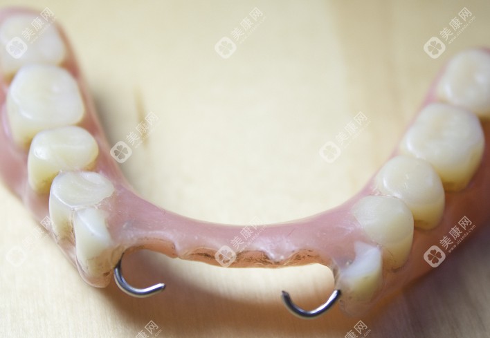 韶关三大镶牙机构对比 韶关三大镶牙机构对比