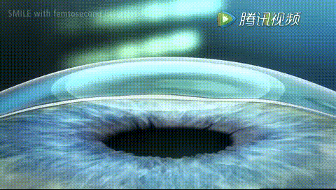 全飛秒
