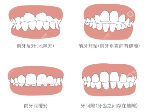 成都新桥口腔牙齿矫正价格表