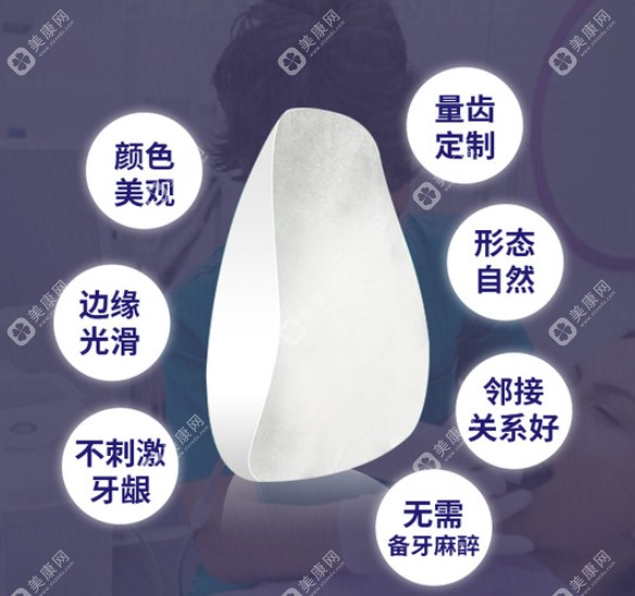 成都新桥口腔牙齿贴面价目表