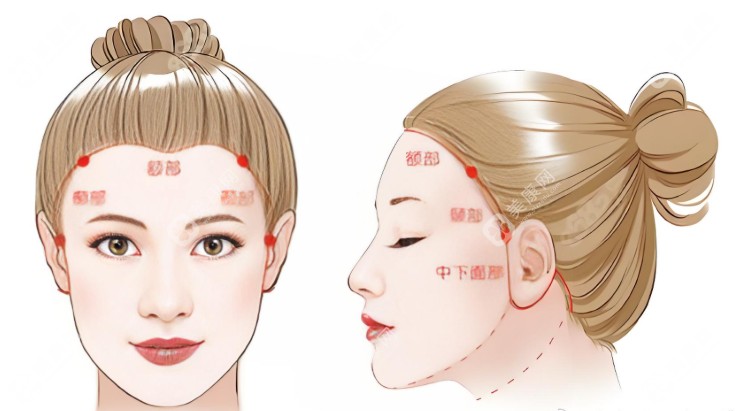 北京筋膜提升術(shù)誰(shuí)做的好