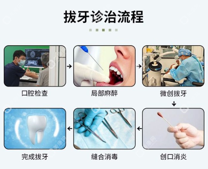 成都新桥口腔假牙价格