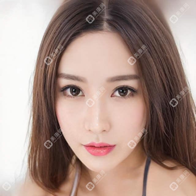 西安内窥镜除皱去鱼尾纹大概是多少钱?微晶磨皮去鱼尾纹1k元左右