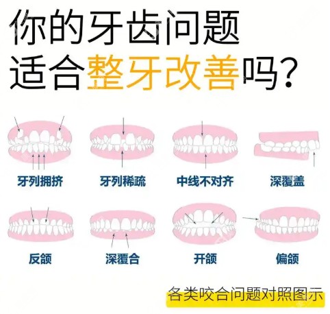 北京牙齒矯正性價比醫(yī)院推薦