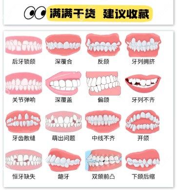北京正畸哪个医院性价比高？2025北京牙齿矫正性价比推荐！金属托槽8000+隐形矫正2w+附防坑价格表