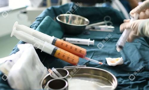 沈陽(yáng)吸脂手術(shù)費(fèi)用1-10萬左右