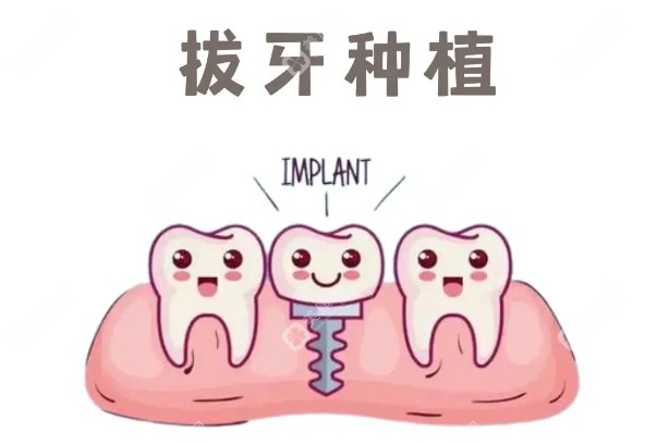 沈阳大海口腔种植牙价格表