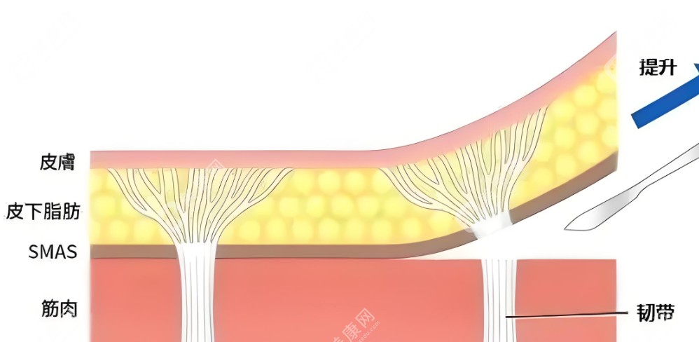 脂肪移植www.slzxedu.com
