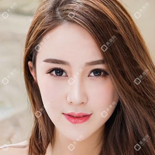 广州美莱&医美俪小拉皮手术价格对比表:广州美莱25000元起,医美俪22000元起,医生推荐及手术费用详解