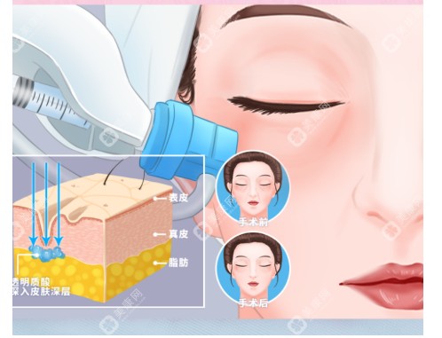 蒋铮铮的美学设计问诊24小时在线预约挂号(原创美学理念讲解+幼态脸看脸分析,重回少女感!)