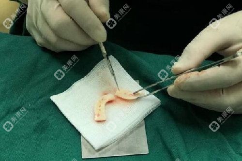 南京鼻修復(fù)醫(yī)生避坑六法則