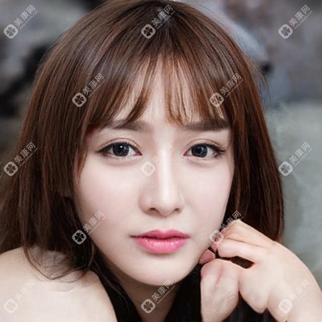 佛山树脂贴面收费表，地址在佛山禅城区/南海区/高明区树脂贴面价格在430-1468元