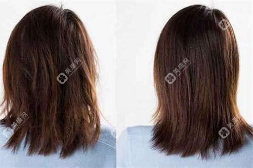 广州突眼矫正手术价格对比表：南方医大三院 vs 广州友好医院，详细眼科费用一览