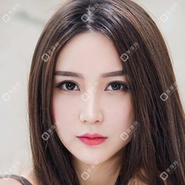 广州市广州医美俪连锁价格揭秘？光子嫩肤3K+ 水光针2K+ 热玛吉5K+