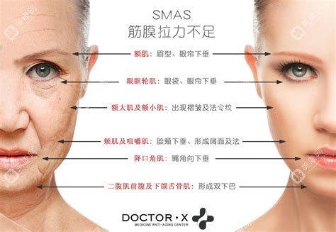 2025無痕筋膜提升2.0哪家醫(yī)院好?技術(shù)口碑價格實例綜合票選《國內(nèi)筋膜提升2.0醫(yī)院排名前十》