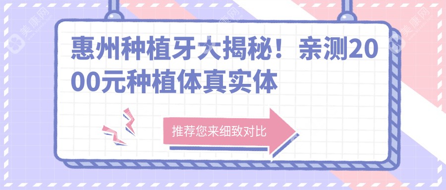 惠州种植牙大揭秘！亲测2000元种植体真实体验，口腔健康不将就
