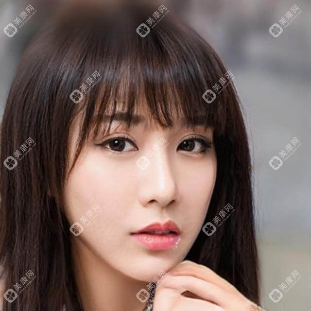 北京碧莲盛植发价格表：发际线调整+鬓角种植多少钱？附各项目费用明细