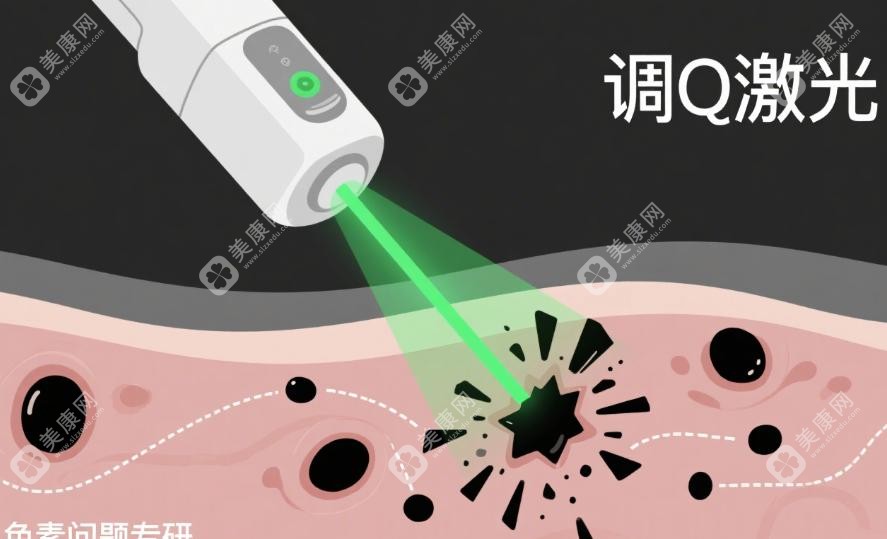 晒出小斑点、肤色不均？强脉冲光来帮忙