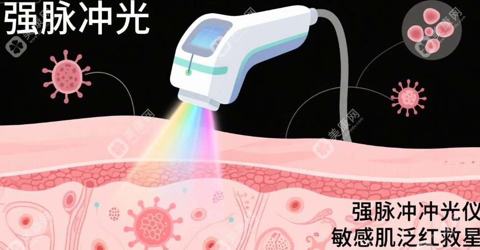 敏感肌防晒没做好？先看看红光治疗适不适合你